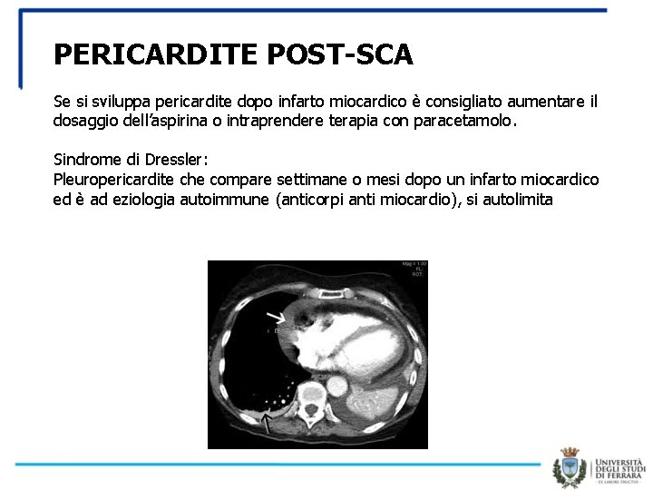 PERICARDITE POST-SCA Se si sviluppa pericardite dopo infarto miocardico è consigliato aumentare il dosaggio