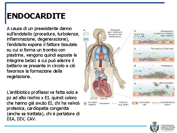 ENDOCARDITE A causa di un preesistente danno sull’endotelio (procedura, turbolenza, infiammazione, degenerazione), l’endotelio espone