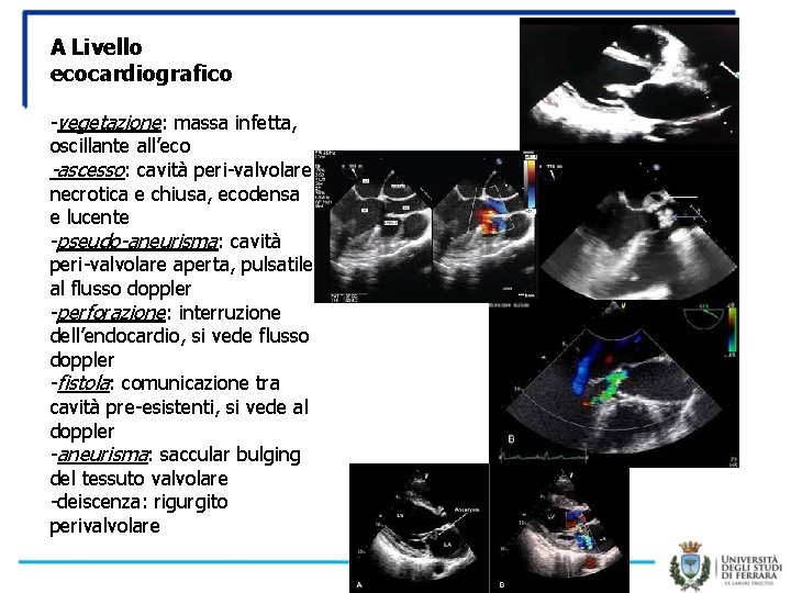 A Livello ecocardiografico -vegetazione: massa infetta, oscillante all’eco -ascesso: cavità peri-valvolare necrotica e chiusa,