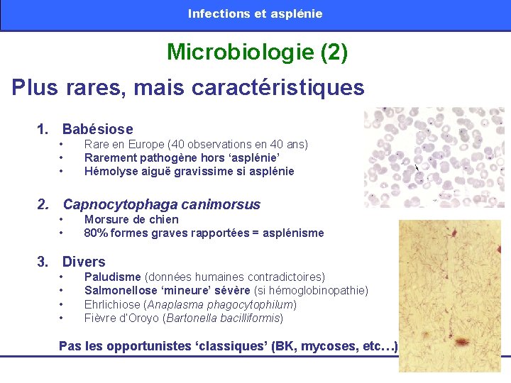 Infections et asplénie Microbiologie (2) Plus rares, mais caractéristiques 1. Babésiose • • •