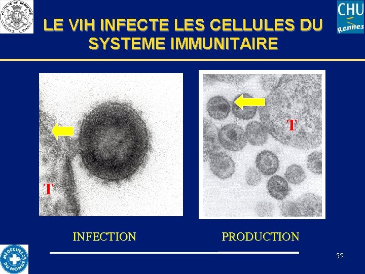 LE VIH INFECTE LES CELLULES DU SYSTEME IMMUNITAIRE T T INFECTION PRODUCTION 55 