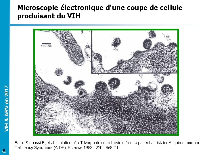 VIH & ARV en 2017 Microscopie électronique d'une coupe de cellule produisant du VIH