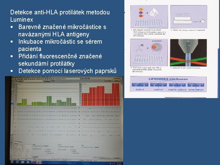 Detekce anti-HLA protilátek metodou Luminex § Barevně značené mikročástice s navázanými HLA antigeny §