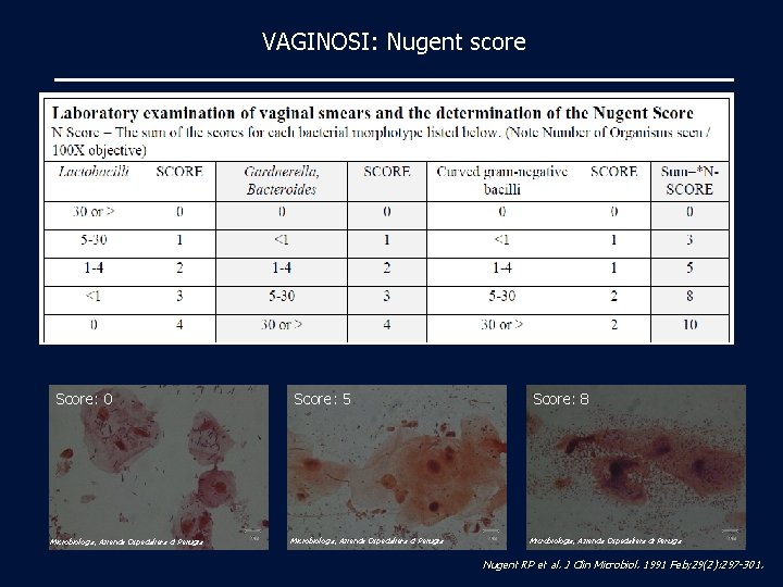 VAGINOSI: Nugent score Score: 0 Microbiologia, Azienda Ospedaliera di Perugia Score: 5 Microbiologia, Azienda