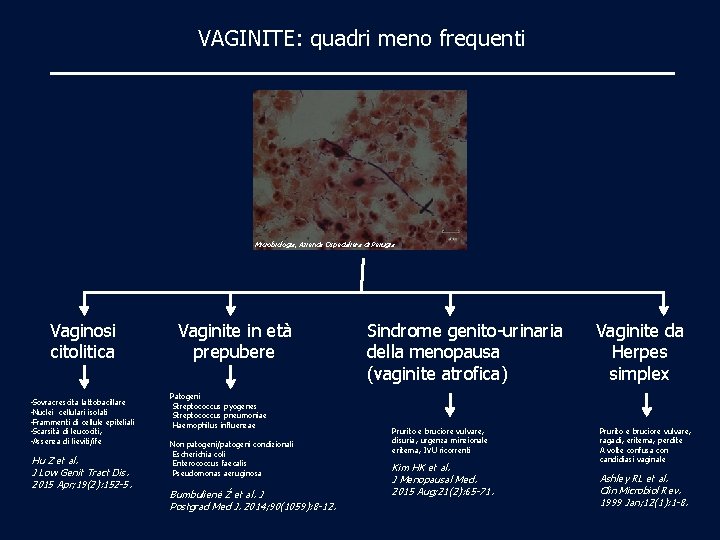 VAGINITE: quadri meno frequenti Microbiologia, Azienda Ospedaliera di Perugia Vaginosi citolitica • Sovracrescita lattobacillare