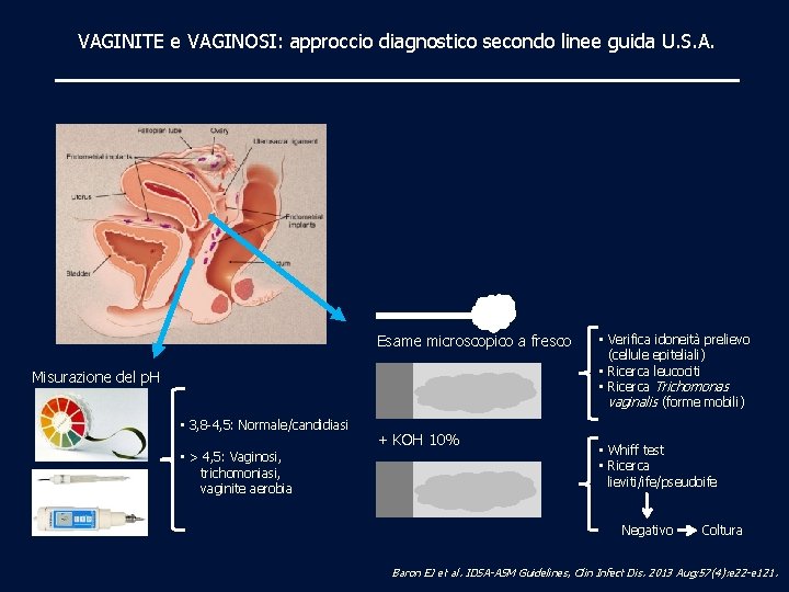 VAGINITE e VAGINOSI: approccio diagnostico secondo linee guida U. S. A. Esame microscopico a