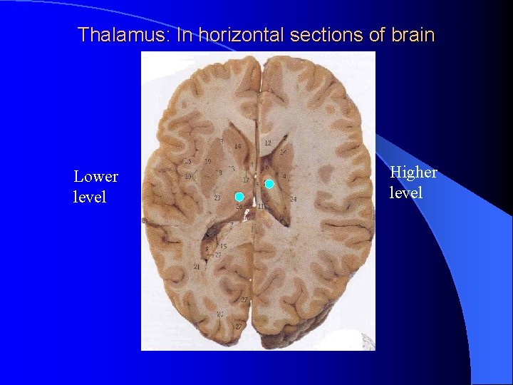 Thalamus: In horizontal sections of brain Lower level Higher level 