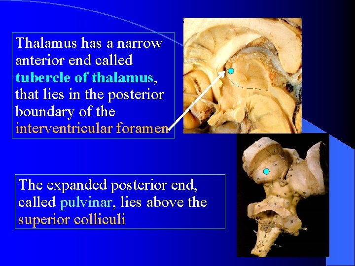 Thalamus has a narrow anterior end called tubercle of thalamus, thalamus that lies in