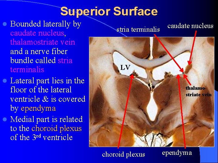 Superior Surface Bounded laterally by caudate nucleus, thalamostriate vein and a nerve fiber bundle