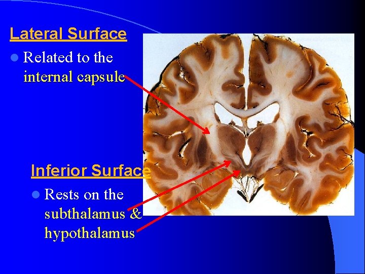 Lateral Surface l Related to the internal capsule Inferior Surface l Rests on the
