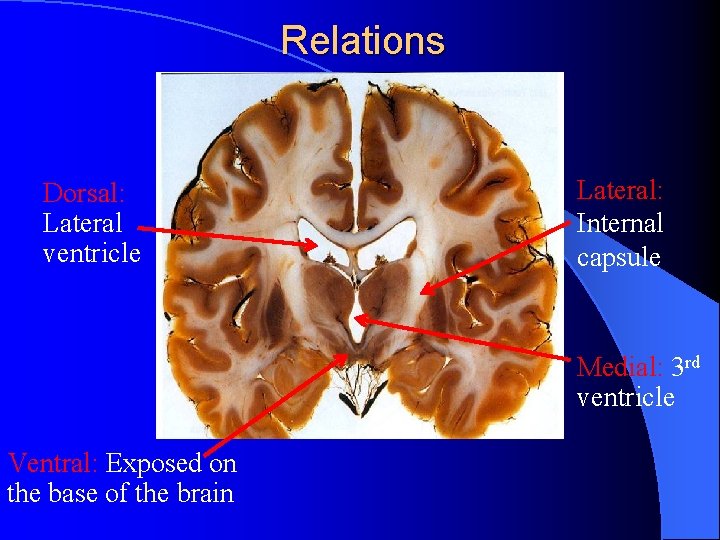 Relations Dorsal: Lateral ventricle Lateral: Internal capsule Medial: 3 rd ventricle Ventral: Exposed on