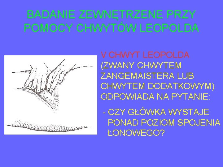 BADANIE ZEWNĘTRZENE PRZY POMOCY CHWYTÓW LEOPOLDA V CHWYT LEOPOLDA (ZWANY CHWYTEM ZANGEMAISTERA LUB CHWYTEM