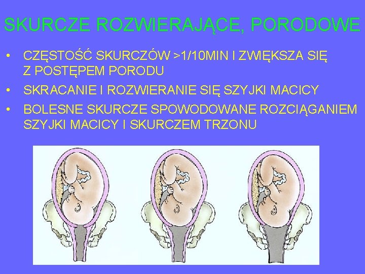 SKURCZE ROZWIERAJĄCE, PORODOWE • CZĘSTOŚĆ SKURCZÓW >1/10 MIN I ZWIĘKSZA SIĘ Z POSTĘPEM PORODU