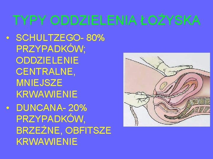 TYPY ODDZIELENIA ŁOŻYSKA • SCHULTZEGO- 80% PRZYPADKÓW; ODDZIELENIE CENTRALNE, MNIEJSZE KRWAWIENIE • DUNCANA- 20%