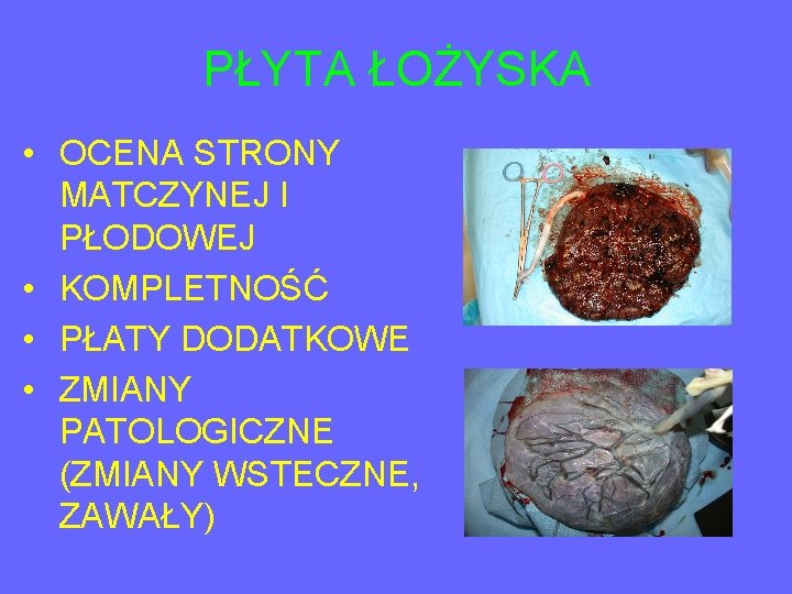 PŁYTA ŁOŻYSKA • OCENA STRONY MATCZYNEJ I PŁODOWEJ • KOMPLETNOŚĆ • PŁATY DODATKOWE •