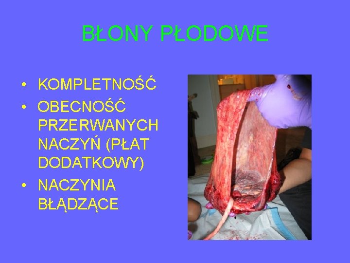 BŁONY PŁODOWE • KOMPLETNOŚĆ • OBECNOŚĆ PRZERWANYCH NACZYŃ (PŁAT DODATKOWY) • NACZYNIA BŁĄDZĄCE 