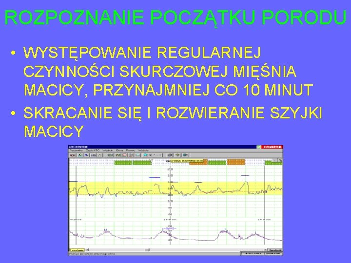 ROZPOZNANIE POCZĄTKU PORODU • WYSTĘPOWANIE REGULARNEJ CZYNNOŚCI SKURCZOWEJ MIĘŚNIA MACICY, PRZYNAJMNIEJ CO 10 MINUT