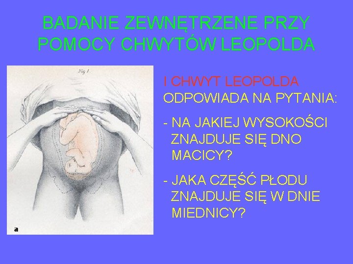 BADANIE ZEWNĘTRZENE PRZY POMOCY CHWYTÓW LEOPOLDA I CHWYT LEOPOLDA ODPOWIADA NA PYTANIA: - NA