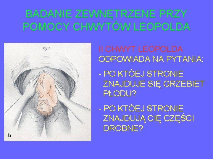 BADANIE ZEWNĘTRZENE PRZY POMOCY CHWYTÓW LEOPOLDA II CHWYT LEOPOLDA ODPOWIADA NA PYTANIA: - PO