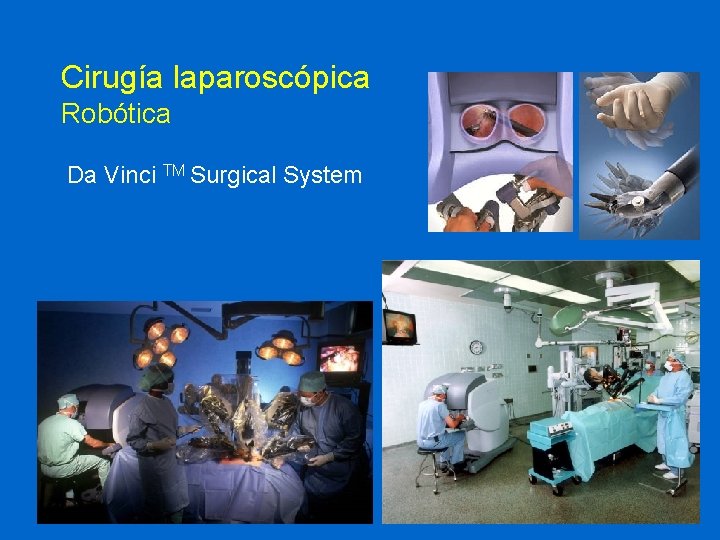 Cirugía laparoscópica Robótica Da Vinci TM Surgical System 