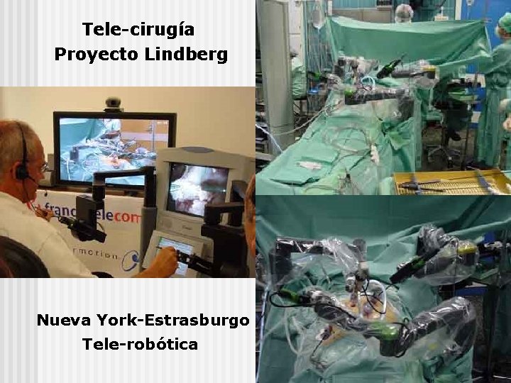 Tele-cirugía Proyecto Lindberg Nueva York-Estrasburgo Tele-robótica 