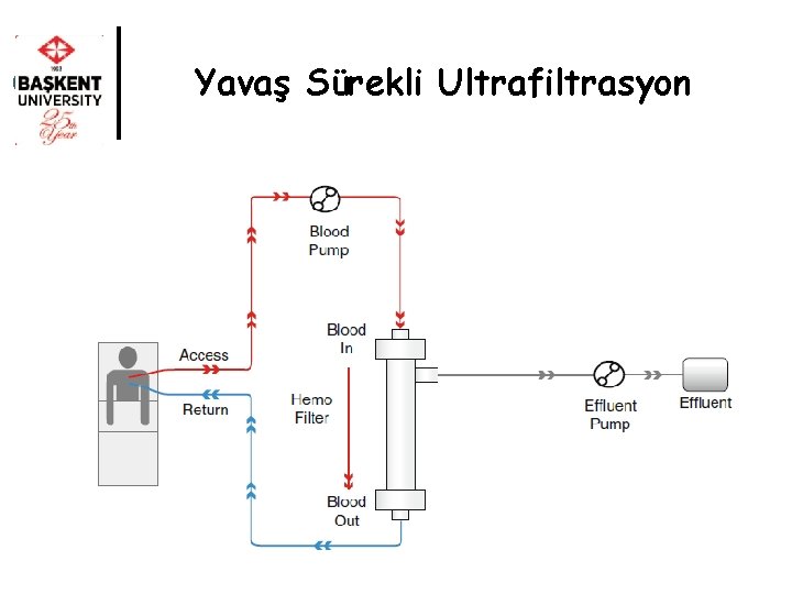 Yavaş Sürekli Ultrafiltrasyon 