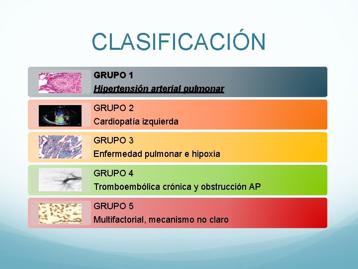 CLASIFICACIÓN GRUPO 1 Hipertensión arterial pulmonar GRUPO 2 Cardiopatía izquierda GRUPO 3 Enfermedad pulmonar CLASIFICACIÓN GRUPO 1 Hipertensión arterial pulmonar GRUPO 2 Cardiopatía izquierda GRUPO 3 Enfermedad pulmonar