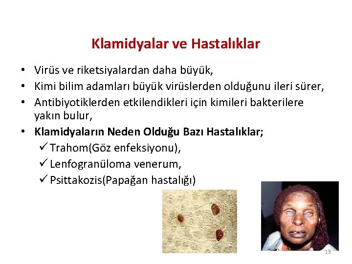 Klamidyalar ve Hastalıklar • Virüs ve riketsiyalardan daha büyük, • Kimi bilim adamları büyük