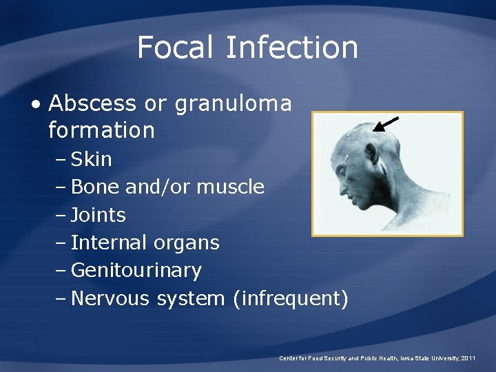 Focal Infection • Abscess or granuloma formation – Skin – Bone and/or muscle –