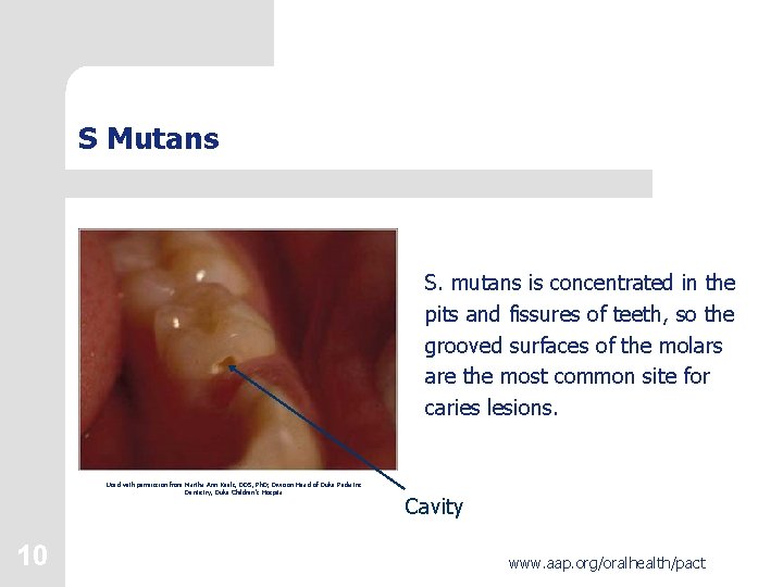 S Mutans S. mutans is concentrated in the pits and fissures of teeth, so