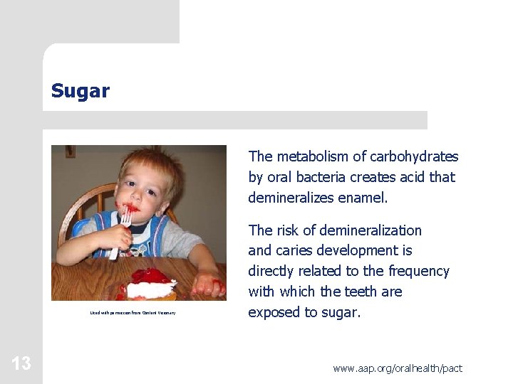 Sugar The metabolism of carbohydrates by oral bacteria creates acid that demineralizes enamel. Used