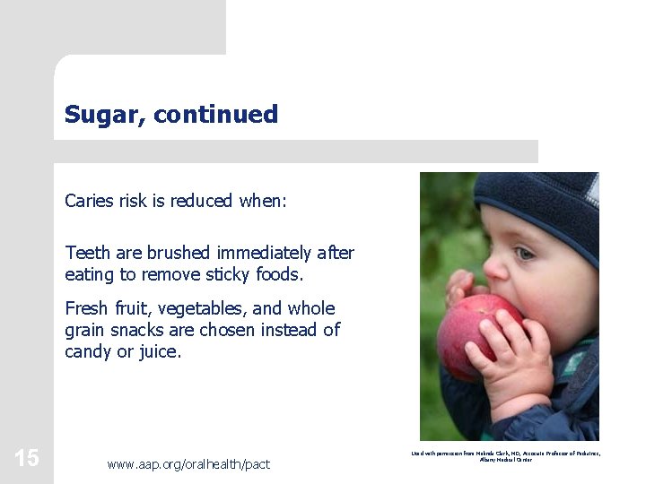Sugar, continued Caries risk is reduced when: Teeth are brushed immediately after eating to