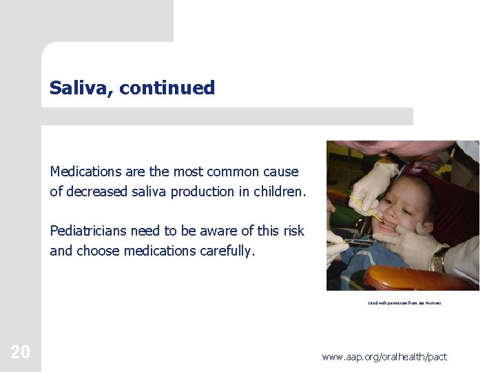 Saliva, continued Medications are the most common cause of decreased saliva production in children.