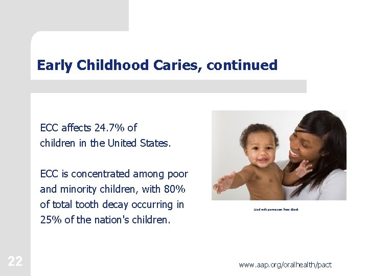 Early Childhood Caries, continued ECC affects 24. 7% of children in the United States.