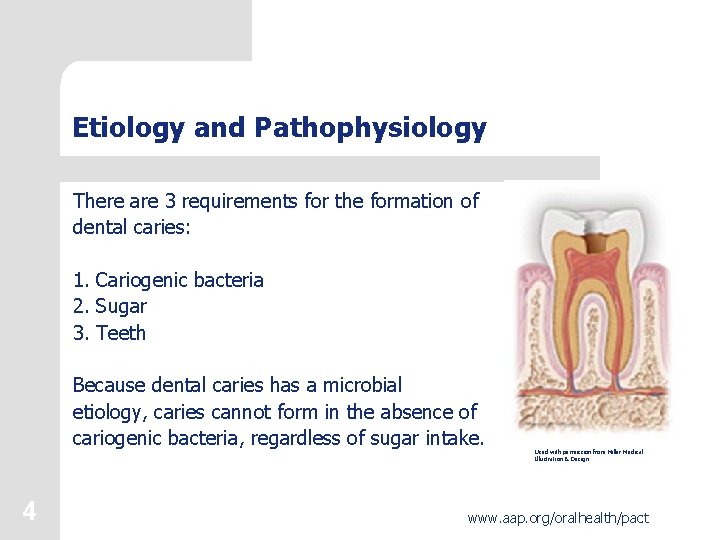 Etiology and Pathophysiology There are 3 requirements for the formation of dental caries: 1.