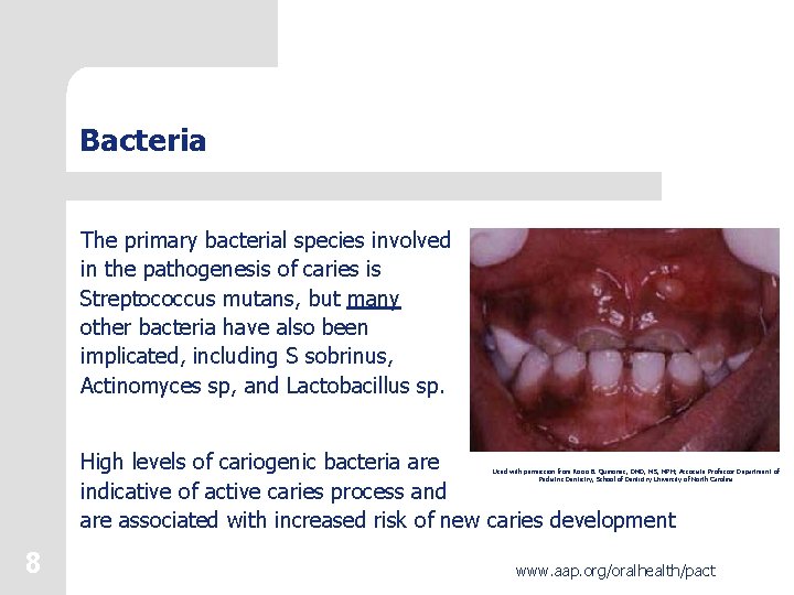 Bacteria The primary bacterial species involved in the pathogenesis of caries is Streptococcus mutans,