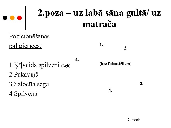 2. poza – uz labā sāna gultā/ uz matrača Pozicionēšanas palīgierīces: 1. Ķīļveida spilveni