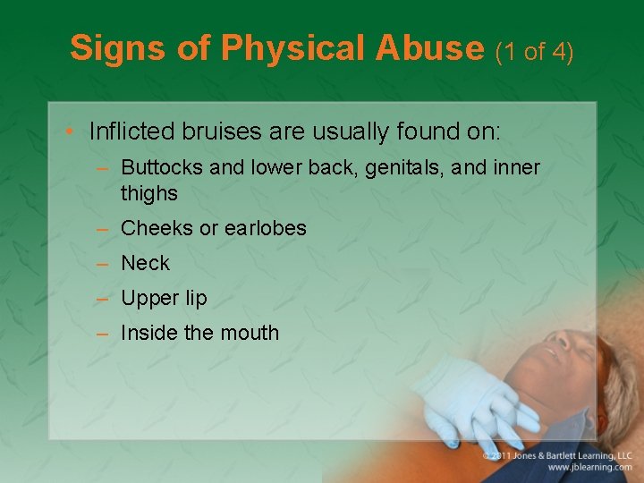 Signs of Physical Abuse (1 of 4) • Inflicted bruises are usually found on:
