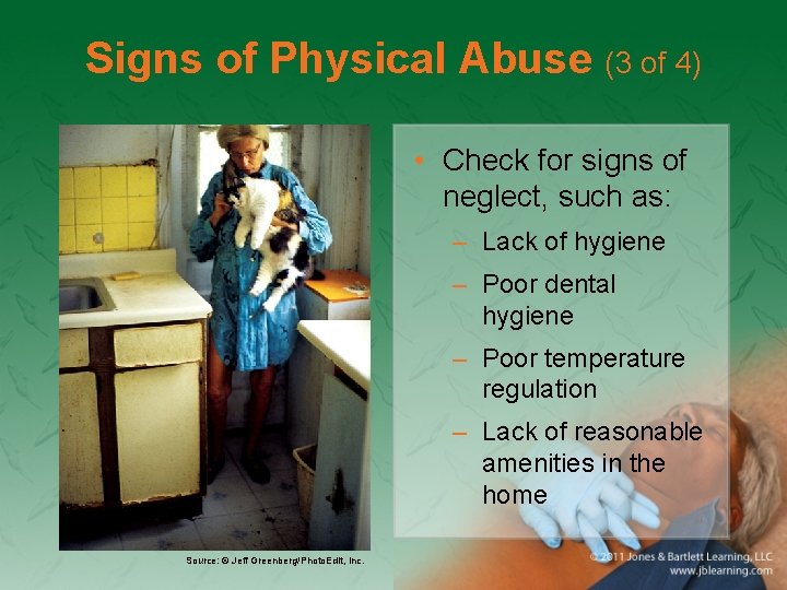 Signs of Physical Abuse (3 of 4) • Check for signs of neglect, such