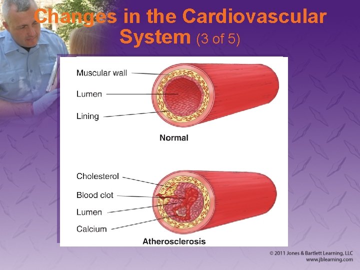 Changes in the Cardiovascular System (3 of 5) 