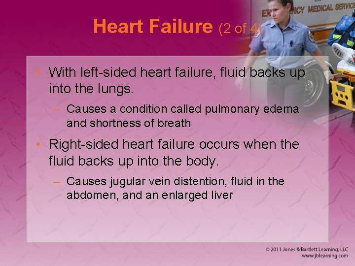 Heart Failure (2 of 4) • With left-sided heart failure, fluid backs up into