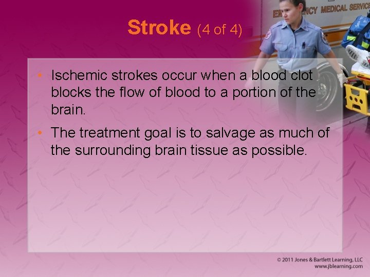 Stroke (4 of 4) • Ischemic strokes occur when a blood clot blocks the