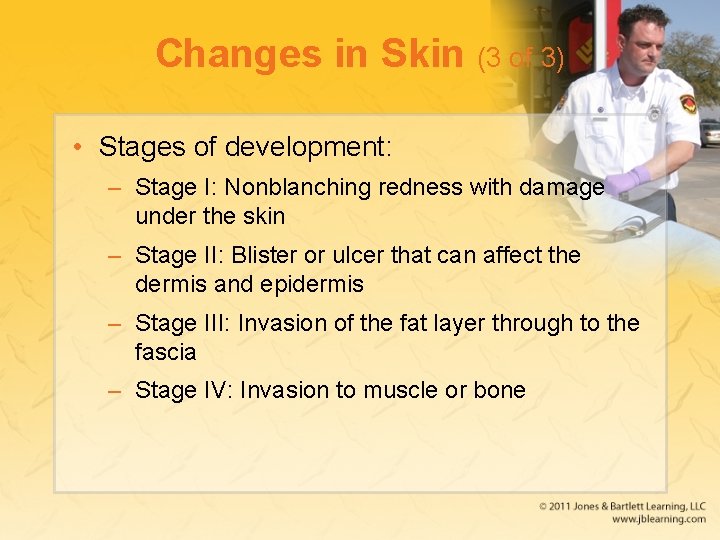 Changes in Skin (3 of 3) • Stages of development: – Stage I: Nonblanching