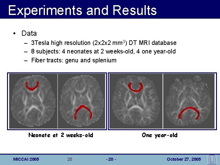 Experiments and Results • Data – 3 Tesla high resolution (2 x 2 x