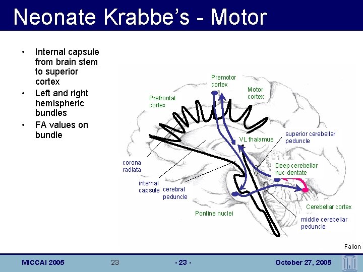 Neonate Krabbe’s - Motor • • • Internal capsule from brain stem to superior