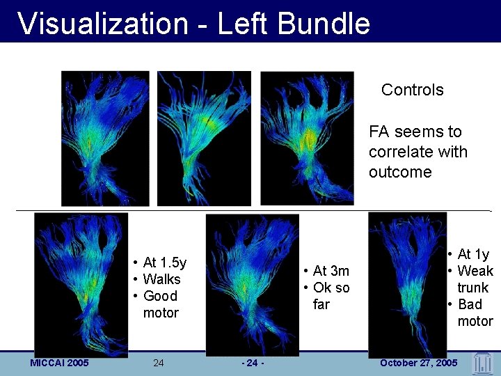 Visualization - Left Bundle Controls FA seems to correlate with outcome • At 1.