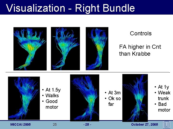 Visualization - Right Bundle Controls FA higher in Cnt than Krabbe • At 1.