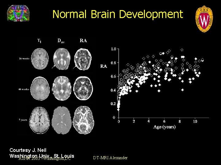 Normal Brain Development Courtesy J. Neil Washington St. Louis ASNR 2003 Univ. , –Washington,