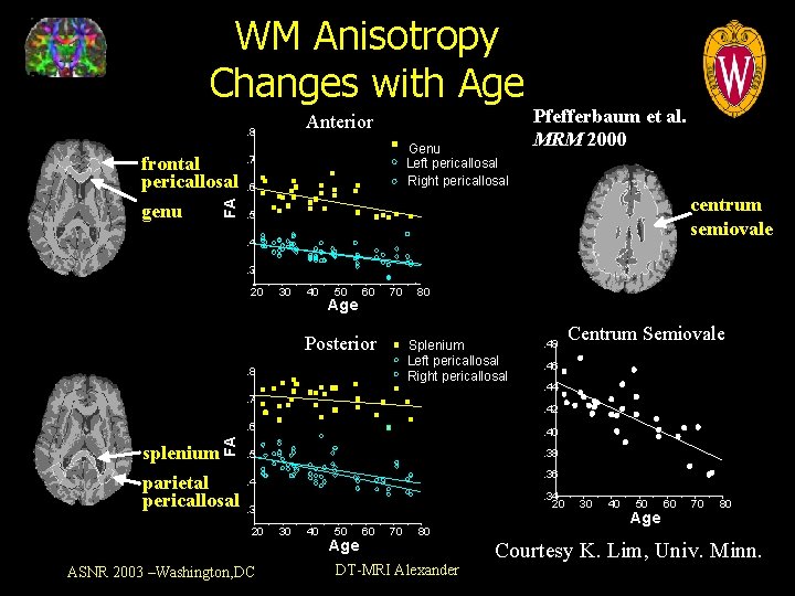 WM Anisotropy Changes with Age Anterior . 8 genu FA frontal pericallosal Genu Left