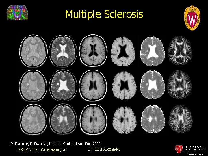 Multiple Sclerosis R. Bammer, F. Fazekas, Neuroim Clinics N Am, Feb. 2002. ASNR 2003
